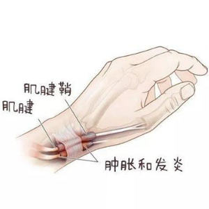<b>Ʒ</b>